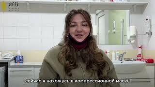 Убираем второй подбородок с помощью FaceTyte. Врач Беер Ирина Николаевна