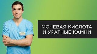 Мочевая кислота и уратные камни | Прямые эфиры с  уролога