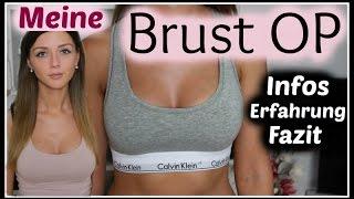 STORYTIME ● BRUST OP / BRUSTVERGRÖßERUNG | Erfahrung | Ablauf | Schmerzen