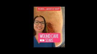 Scabs: Wound Care | @LevelUpRN