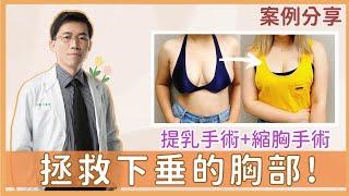 【提乳+縮胸手術｜真實見證】二寶媽的苦誰人知  讓產後下垂的ㄋㄟㄋㄟ找回正確位置｜整形外科 陳廣得醫師