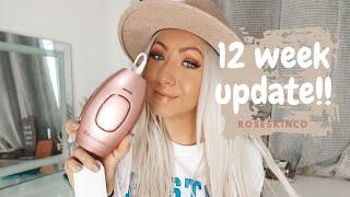 ROSESKINCO IPL LASER HAIR REMOVAL 12 WEEK UPDATE