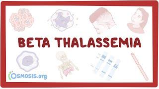 Beta-thalassemia - causes, symptoms, diagnosis, treatment, pathology