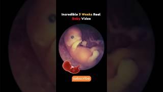 9 Weeks Baby Real Video From Womb Incredible #pregnancy #fetus