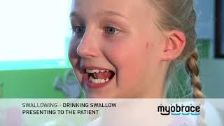 G3 Swallowing   Drinking Swallow