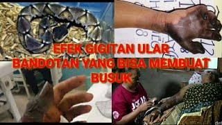 #ularbandotan efek gigitan ular bandotan yang bisa membuat busuk