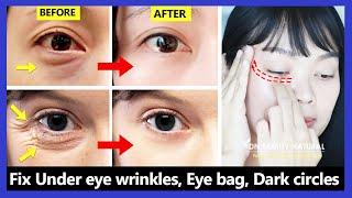 Only 6 mins!! Eye rejuvenation. Get rid of under eye wrinkles, dark circles, eye bags, Crow's feet