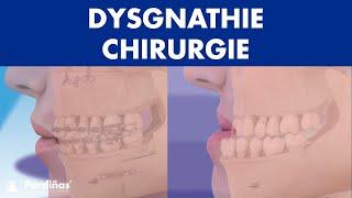 DYSGNATHIE Chirurgie - Alles über kieferorthopädische Chirurgie ©