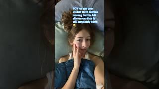 Wisdom teeth removal #shorts #fyp #ytshorts #sophiaforealz #wisdomteethremoval #wisdomteeth