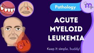 Acute Myeloid leukemia |General pathology| Examination| Diagnosis| Classification | Treatment