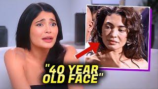 Kylie Jenner BREAKSDOWN After Her Botched Frozen Face Surgery