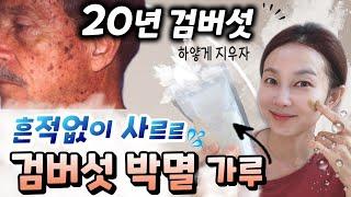 악질 검버섯도 박멸시켜 주는 00가루팩!! 주2회 꼬박꼬박  꾸준하게 하시면 옅어지고 예방됩니다!! 50세이후라면 필수예요!!