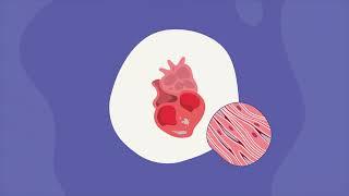 Transthyretin Amyloidosis