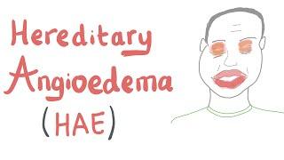 Hereditary Angioedema (HAE)