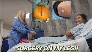 I GOT A MASS REMOVED FROM MY LEG!