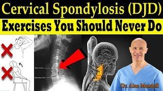 Cervical Spondylosis (DJD) Exercises You Should Never Do (Correct Exercises) - Dr. Alan Mandell, DC