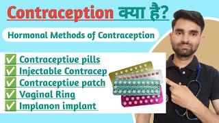 Hormonal Methods of Contraception in Hindi | Contraceptive Methods in Hindi