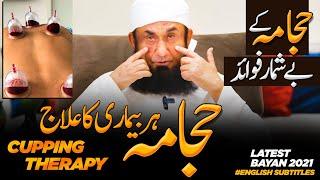 Cupping - Cure To Every Disease | Benefits of Cupping Therapy | Molana Tariq Jamil 3 March 2021