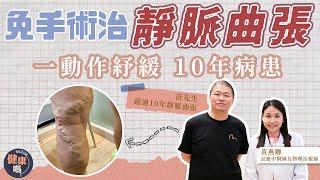 10年靜脈曲張做1個動作 還原健康雙腿｜患者感謝醫師「將不可能變可能」｜中醫不封血管 全面調通血氣｜健康嗎 @HealthCodeHK  ft @WongEC_physio #靜脈曲張 #中醫