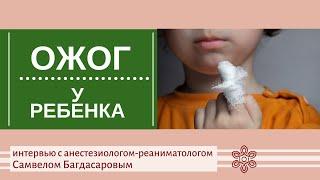 Ожог у ребенка. Как помочь малышу? Советы врача-реаниматогола.