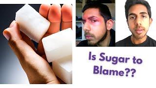 Is Sugar a Drug? | Does Sugar cause Disease?