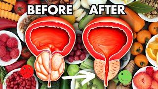 6 Best Vitamins to SHRINK an ENLARGED PROSTATE | #Prostatediet #prostatefood