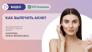 Как вылечить акне?