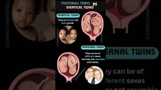 Fraternal vs Identical  Twins,A Look Inside the Womb | development stages #shortsfeed #shorts #baby