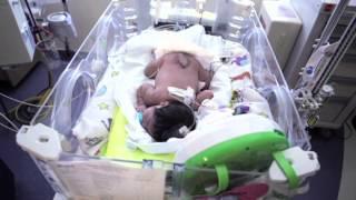 Newborn Baby with Spina Bifida Undergoes Multiple Surgeries