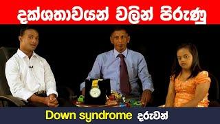 විශේෂ අවශ්‍යතා ඇති ලමුන්ගේ දක්ශතාවය බලන්න  ඔබට පුදුමහිතේවී   down syndrome