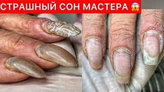 «ПОЛНЫЙ ФАРШ»ОНИХОЛИЗИС+КЛЮЮЩИЕ НОГТИ +СЛОЖНАЯ КУТИКУЛА