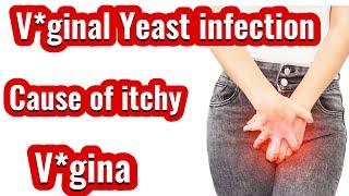 What causes Yeast Infection. How to get rid of Yeast Infection. Thrush , Candidiasis.