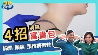 【脖子後面腫一坨】4招消除富貴包　體態.身體都變好【feat.脊椎保健達人 鄭雲龍｜健康主播鄭凱云】