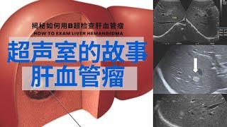 肝血管瘤 ： 肝血管瘤是什么/病因/危险人群/常见症状/超声是如何检查/治疗方法【Ultrasound Room】Liver Hemangioma