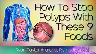 Foods That Prevent Polyps in the Colon