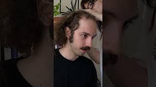 Balding Man WOWED By New Look! 