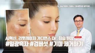 AI혁신일까, 난치성 #일광흑자 #검버섯 #기미 까지 by 리팟레이저 #닥터최승 #최승원장 #리팟 #리팟레이저
