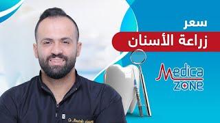 ما هو سعر زراعة الاسنان | دكتور مصطفى العجمي