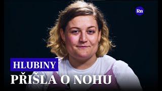 Patricie po nehodě na Bali přišla o nohu | HLUBINY