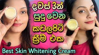 කළු අයට සුදු වෙන්න හරිම ක්‍රීම් එක | Best Skin Whitening Cream | DIY | Kadalapiti Cream