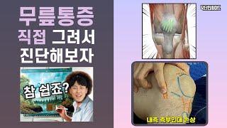 무릎 아플 때 꼭 보세요! - 직접 그려가며 알아보는 무릎 통증의 원인! [닥터인사이드]