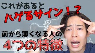 【必見】生え際やM字の薄毛・ハゲるサインを解説。前髪薄毛の４つ特徴【自宅チェック】