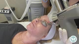 Monarch Skin Rejuvenation Profractional - Live