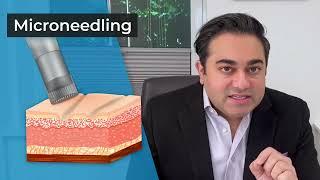 Can Microneedling Improve Scar Appearance? — Video Discussion by Sachin Shridharani, MD, FACS