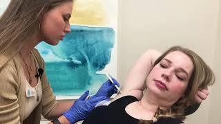 Botox to treat Hyperhidrosis (Excessive Sweating) | Nashville Injector