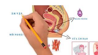 Phòng khám đa khoa 52 Nguyễn Trãi - Làm thế nào để tự kiểm tra âm đạo tại nhà