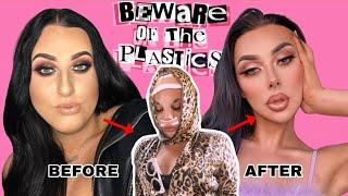 PLASTIC SURGERY BEFORE & AFTER | FACIAL FEMINISATION SURGERY RESULTS