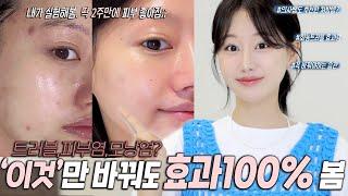 여드름피부 필수‼️ 제발..'이것'만 바꿔해보세요. 2주만에 효과 100%봅니다. (내가 실험해봄!)ㅣ트러블추천템, 세안추천법, 놓치는습관등 ㅣ 인보라INBORA