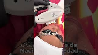 Trata las Manchas y Pecas con nuestro láser IPL en Paloma Clinic Spa