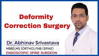 Deformity Correction Surgery | Patient Recovery | Dr Abhinav Srivastava